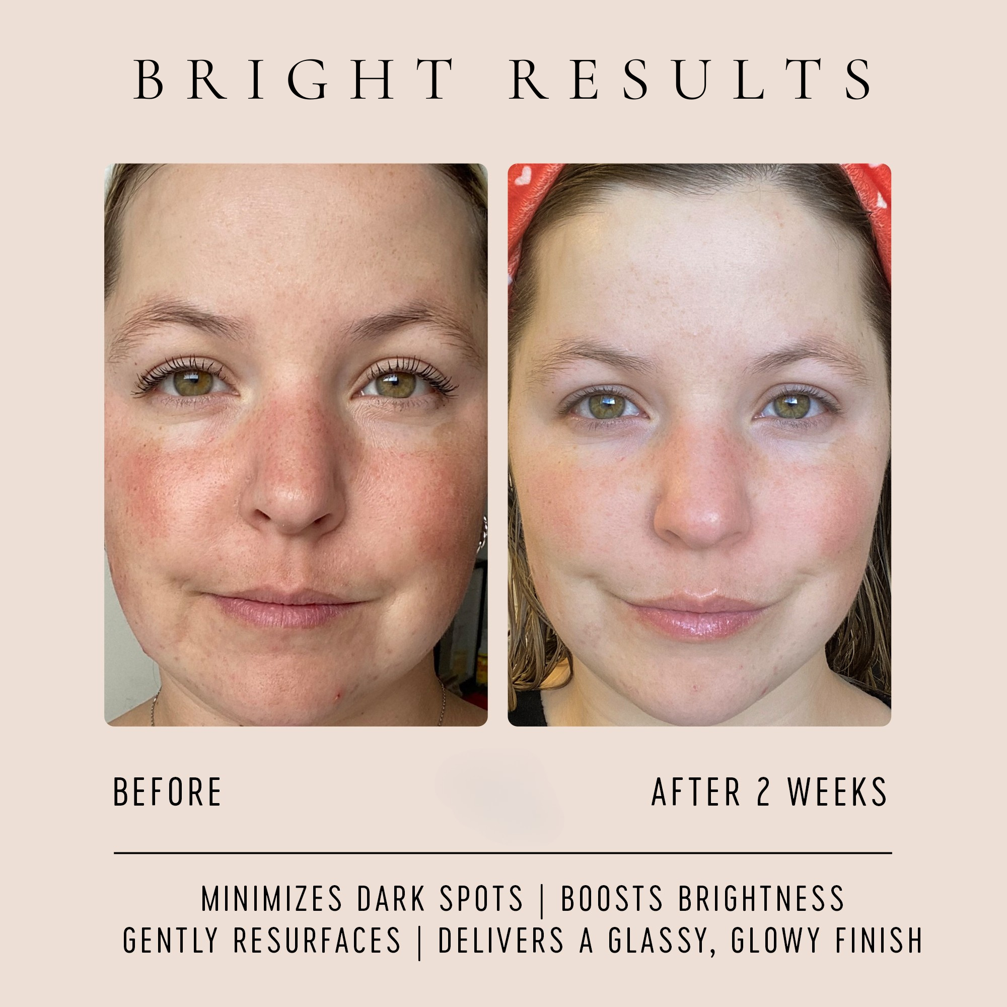 Vitamin C Glow Drops